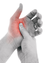 Complex Regional Pain Syndrome