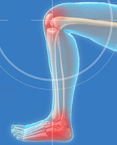 Knee and Foot Pain