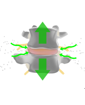 Lumbar Micro-decompression